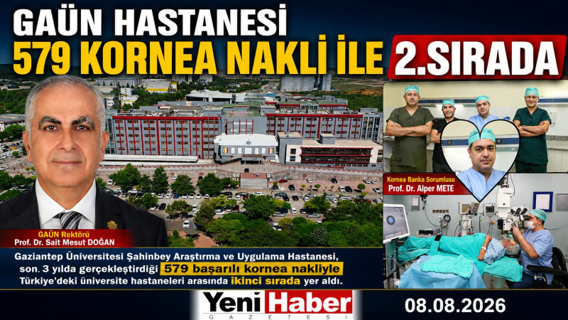 GAÜN HASTANESİ 579 KORNEA NAKLİ İLE TÜRKİYE'DE  2.SIRADA 